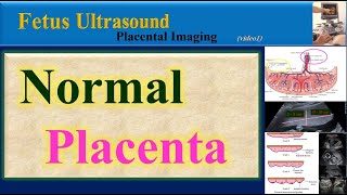 Fetus Ultrasound  Normal Placenta [upl. by Tessler]