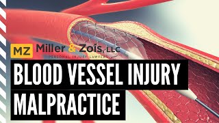 Blood Vessel Injury Malpractice [upl. by Frasier389]