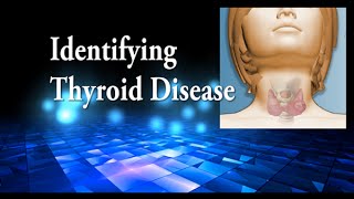 Identifying Thyroid Disease Monique Manganelli MD Endocrinologist [upl. by Forrester]