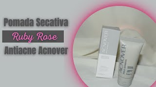 Pomada Secativa Antiacne Acnover Ruby Rose [upl. by Zales]