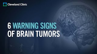 6 Warning Signs of Brain Tumors [upl. by Selokcin]