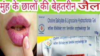 Choline Salicylate amp Lignocaine Hydrochloride Uses in Hindi [upl. by Calvo]