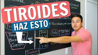 Tiroides tienes que hacer este examen [upl. by Anitsuga]