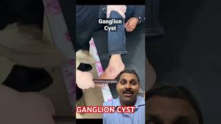 Ganglion cyst [upl. by Dario]