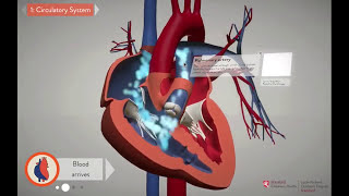 Repairing the Heart Unifocalization  Stanford Childrens Health [upl. by Ennaharas]