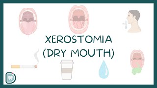 Dry Mouth or Xerostomia Causes Symptoms Diagnosis and Treatment [upl. by Moia]