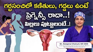 Understanding Uterine Fibroids And Causes  DrSwapna Chekuri  Hyderabad Fertility Center [upl. by Kolosick]