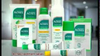 Acnes Treatment Series 05102010 [upl. by Coumas]