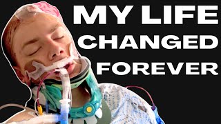 My Traumatic Brain Injury Story  GoForBrandon Accident Documentary [upl. by Haggi]