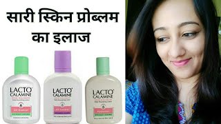 LACTO CALAMINE LOTION REVIEW IN HINDI FOR OILY amp DRY SKIN HOW TO APPLYUSE BENEFITS [upl. by Ahsial462]