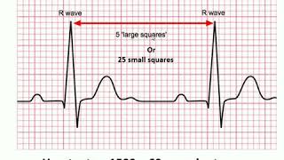 ECG 01  HEART RATE CALCULATION [upl. by Idnal1]