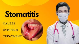 quotStomatitis Symptoms Causes and Treatment  Comprehensive Guide for Oral Healthquot [upl. by Llehcal813]