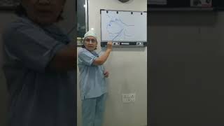 Use of Video Laryngoscope [upl. by Erin674]