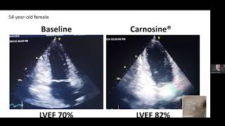 How Carnosine Benefits the Heart [upl. by Lait]