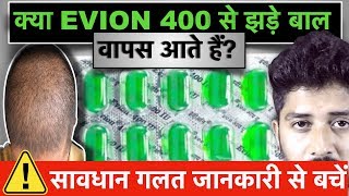 VITAMIN E Capsule For HAIR GROWTH  SKIN AND HEALTH EVION 400 Uses and Side Effects [upl. by Darra]