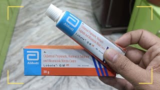 Lobate GM  Clobetasol Neomycin amp Miconazole Cream Uses In Hindi  LOBATE GM Neo Cream Uses In Hindi [upl. by Raycher111]