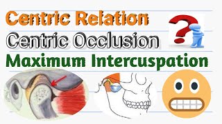 Concept of CENTRIC RELATION CENTRIC OCCLUSION MAXIMUM INTERCUSPATIONtheir Inter Relationships [upl. by Esile]