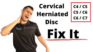 Cervical herniated disc exercises [upl. by Ahseihs]