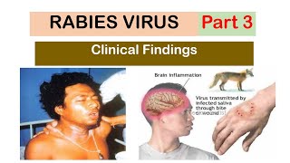 What are the Clinical Findings of Rabies Infection [upl. by Erik]