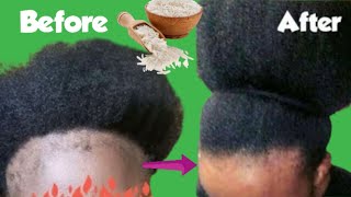 How To Use Fermented Rice Water and Onion Juice for Fastest Hair Growth at home naturally [upl. by Oliver]