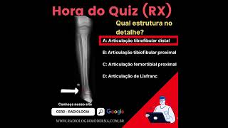 Articulação tibiofibular distal [upl. by Drusilla975]