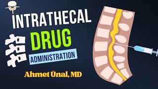 INTRATHECAL DRUG ADMINISTRATION AND CSF SAMPLE  ANIMATION [upl. by Citarella]