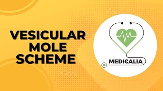 Vesicular mole Scheme  Mnemonics [upl. by Ahsiet]