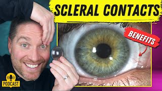 The Amazing Benefits Of Scleral Contact Lenses [upl. by Zipnick]