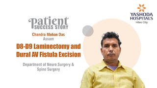 D8D9 Laminectomy and Dural AV Fistula Excision  Yashoda Hospitals Hyderabad [upl. by Baker]