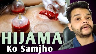 Hijama Cupping Therapy In Hindi [upl. by Flori23]