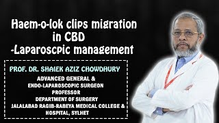 Hemolok clips migration in CBD Laparoscopic management [upl. by Mohorva]