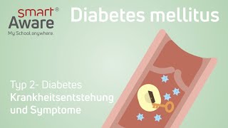 Diabetes Mellitus Krankheitsentstehung und Symptome  Fachfortbildungen in der Pflege  smartAware [upl. by Maryly231]