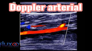 Doppler arterial dos membros inferiores  Artéria fibular na perna shorts [upl. by Solitta]