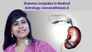 Diabetes insipidus in Medical Astrology [upl. by Ikairik]