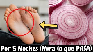 ✅ ¿Para qué SIRVE la CEBOLLA en la planta de los PIES en NIÑOS 💥 BENEFICIOS de la Cebolla en NIÑOS [upl. by Frieda611]