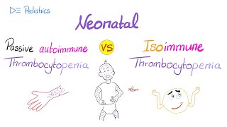 Passive Autoimmune Thrombocytopenia vs Isoimmune Thrombocytopenia  Low Platelets in Neonates [upl. by Bathelda525]