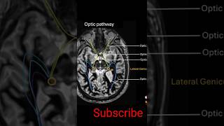 Optic Pathway anatomy shorts mri [upl. by Atsyrt]