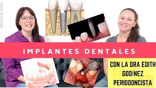 TODO SOBRE Implantes Dentales 🔩 🦷 con Dra Edith Godínez Padilla [upl. by Anjela]