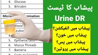 Urine Test in HindiUrdu  Understand Urine Analysis Report  How to Read Urinalysis Result [upl. by Lateh]