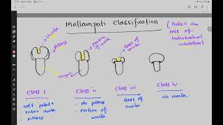 Mallampati Classification [upl. by Drauode221]