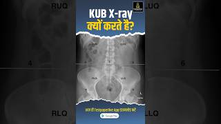 KUB Xray Test Purpose Preparation amp Procedure  radiographer xraytechnician peramedical [upl. by Sauder72]