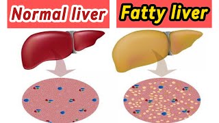 The Top 10 Foods for a Healthy Liver Your Ultimate Guide Against Fatty Liver [upl. by Veron626]