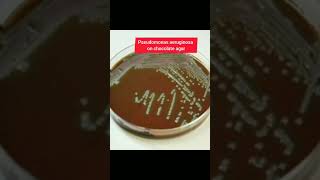 Pseudomonas aeruginosa growth on various type media [upl. by Arais]