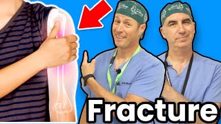 Shoulder Fracture  Causes and Treatments [upl. by Retsevel]