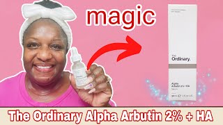 Fade dark spots amp melasma Review of The Ordinary Alpha Arbutin 2  HA [upl. by Norvall264]