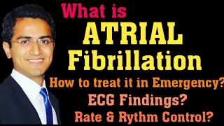 ATRIAL FIBRILLATION AFIB TREATMENT ECG INTERPRETATION PATHOPHYSIOLOGY AFIB MANAGEMENT LECTURE [upl. by Charters526]