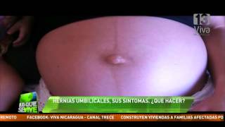 Hernias umbilicales ¿Se curan [upl. by Alludba]