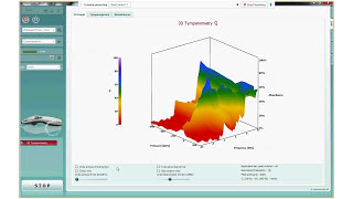 Wideband Tympanometry WBT Theory and Benefits [upl. by Namor]