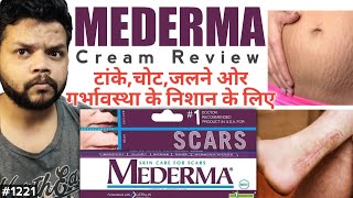 चोट के निशान हटाने वाली क्रीम  Mederma Cream Review  Cream For Acne Scars In Hindi [upl. by Norina]