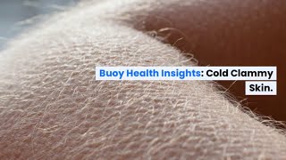 Cold Clammy Skin Common Causes and When to Seek Medical Care  BuoyHealthcom [upl. by Hourihan442]